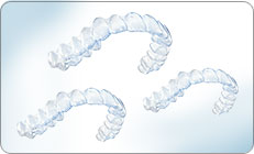 Invisalign